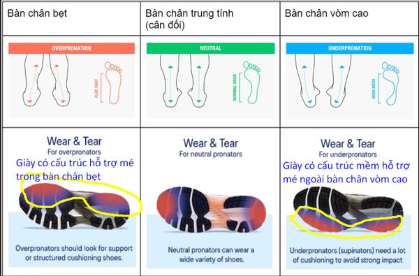 Bàn chân bẹt cần giày hỗ trợ