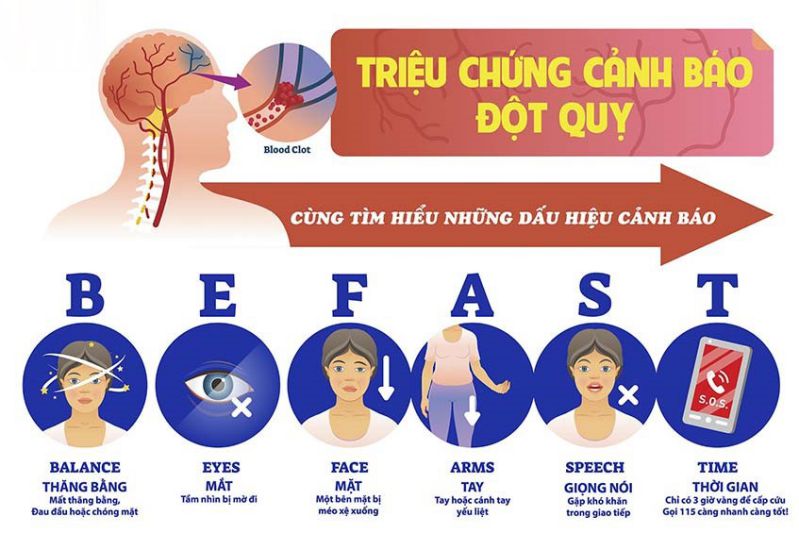 Triệu chứng đột quỵ ( tai biến mạch máu não) và các dấu hiệu có liên quan chẳng hạn như không còn khả năng đi đứng, di chuyển hoặc một nửa cơ thể không còn cảm giác, vấn đề nói cũng không rõ chữ nữa, chóng mặt hoặc mất thị lực sang một bên,... chúng thường xuất hiện ngay sau khi đột quỵ xảy ra.