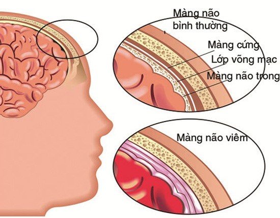 Béo phì ở trẻ hiện nay đang bị báo động với sự gia tăng ngày càng cao, vì thói quen ăn uống, vận động không đồng đều, lối sống phụ thuộc vào các thiết bị thông minh nhiều hơn việc tiếp xúc thiên nhiên,... là nguyên nhân hàng đầu.