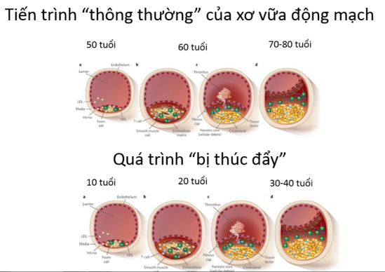 Béo phì ở trẻ hiện nay đang bị báo động với sự gia tăng ngày càng cao, vì thói quen ăn uống, vận động không đồng đều, lối sống phụ thuộc vào các thiết bị thông minh nhiều hơn việc tiếp xúc thiên nhiên,... là nguyên nhân hàng đầu.